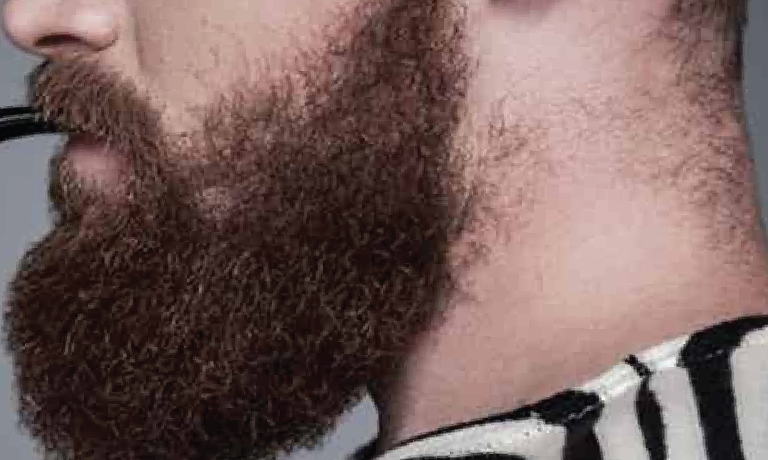 Original Image